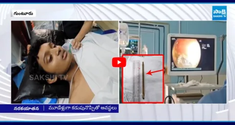 Guntur GGH Doctors Remove Pen From Boy Stomach After 3 Years 1