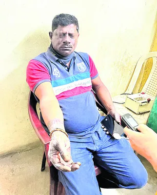 ఎస్టీపీపీలో ప్రమాదం.. ఆపరేటర్‌కు గాయాలు
