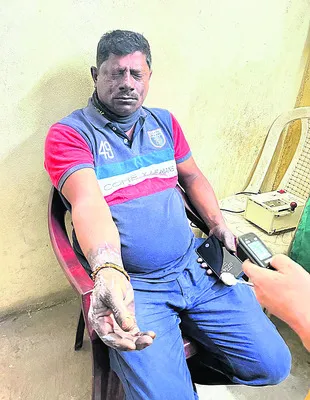 ఎస్టీపీపీలో ప్రమాదం.. ఆపరేటర్‌కు గాయాలు