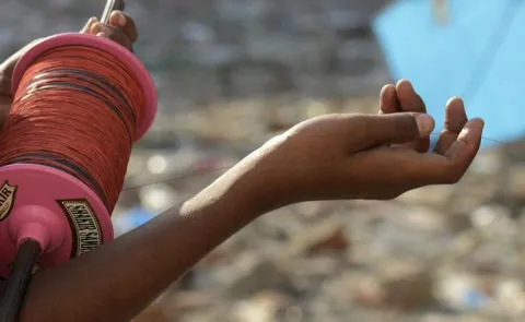 A Person In Visakha Madhurawada Injured By Manja