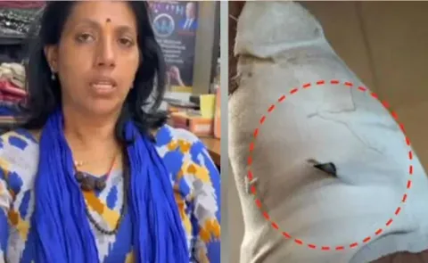 Surgical Blade Left Inside Bandage Medical Negligence