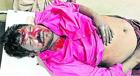 ఆటో బోల్తా.. వ్యక్తి మృతి 