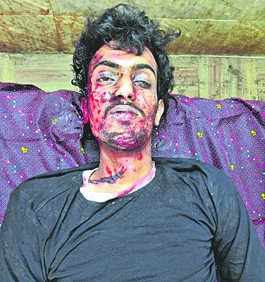 రోడ్డు ప్రమాదంలో యువకుడు మృతి 