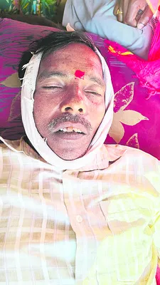 ట్రాన్స్‌ఫార్మర్‌ మరమ్మతు చేస్తుండగా షాక్‌