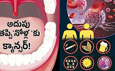 62 percent of mouth cancer cases in India due to alcohol and tobacco: Study