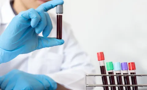 Abu Dhabi rolls out blood test capable of detecting 70 plus cancer types
