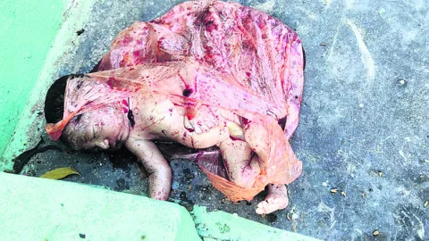 విసిరేసిన మాతృత్వం..