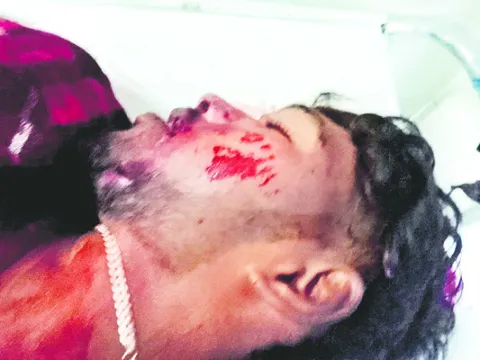 రోడ్డు ప్రమాదంలో విద్యార్థి దుర్మరణం 