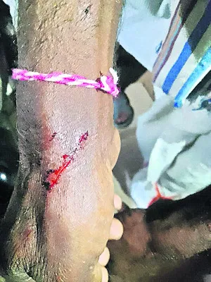 గొర్రెల కాపరులపై హైనా దాడి? 