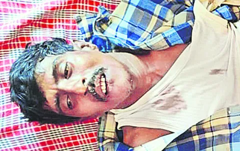 జోగి సోదరుల బెయిల్‌ పిటీషన్‌ 