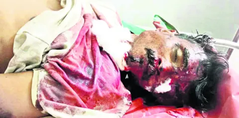 వాహనం ఢీకొని గుర్తు తెలియని వ్యక్తి మృతి