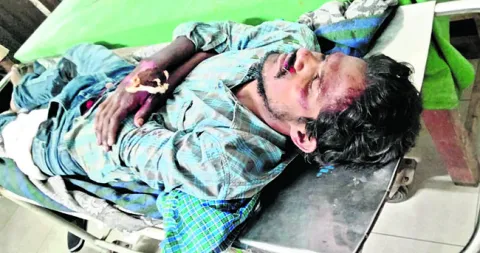 రోడ్డు ప్రమాదంలో స్కూటరిస్టుకు తీవ్ర గాయాలు