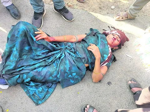 రోడ్డు ప్రమాదంలో  మహిళకు తీవ్రగాయాలు