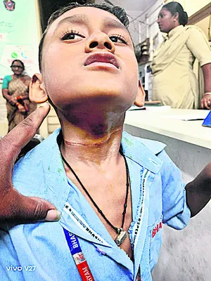 మెడకు చుట్టుకున్న మాంజా దారం 