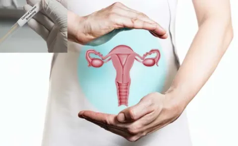 Health: What Is An At-Home Cervical Cancer Screening Test