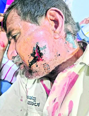 బైరతి బసవరాజుకు  ఆస్పత్రిలో చికిత్స చేయించండి 