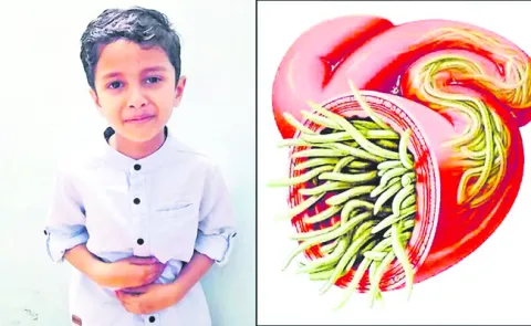 ఒక్క మాత్రతో నులిమేద్దాం..