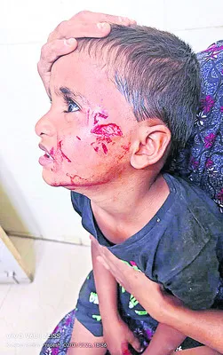 చిన్నారులపై కుక్కల దాడి 