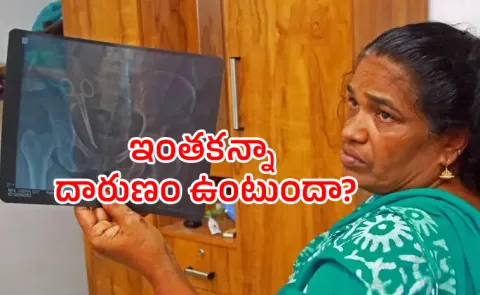 Scissors found in womans abdomen 5 years after surgery