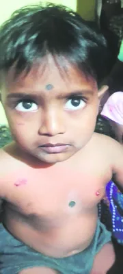 వీధి కుక్కల దాడిలో ఏడుగురికి తీవ్ర గాయాలు
