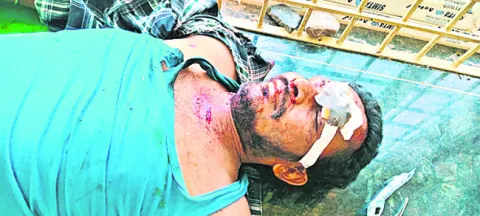 రోడ్డు ప్రమాదంలో వ్యక్తికి తీవ్ర గాయాలు