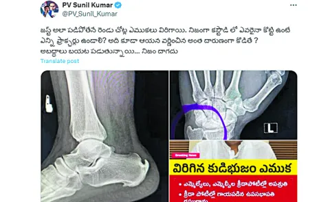 Senior IPS Sunil Kumar on Raghuramakrishna Rajus broken bones