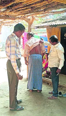 పల్లెల్లో కుష్ఠు కలకలం!