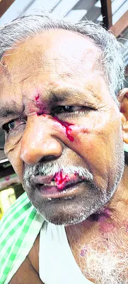 పిచ్చికుక్క స్వైరవిహారం