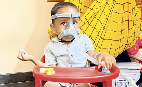 Three-year-old child has rare disease