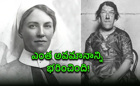 heart breaking story World Ugliest Woman feeds her children