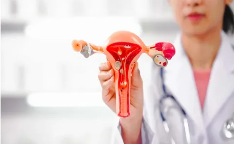 Health Tips: How to take Care of Menstrual Hygiene During Periods