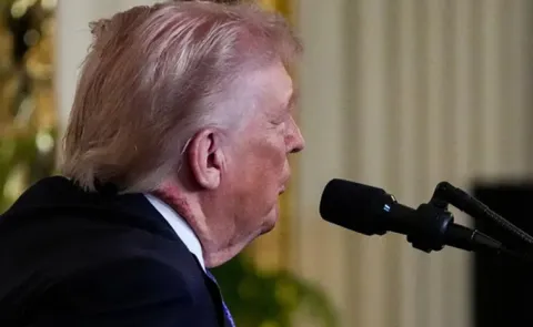 white house doctor Clarity donald trump neck mark explained