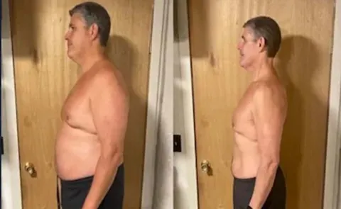 Weight Loss Tips: 48-Year-Old US Man Lost 32 Kg In 6 Months