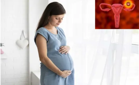 Health Tips: Ectopic Pregnancy: Causes Symptoms And Treatments