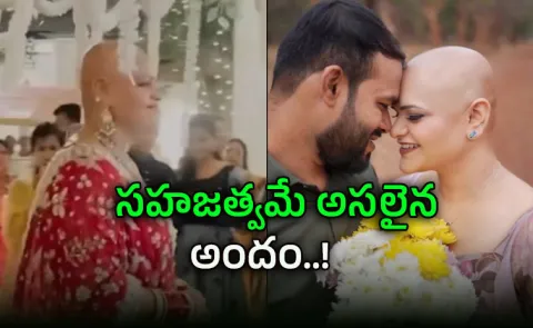 her wedding: Everyone didnt see a bald bride