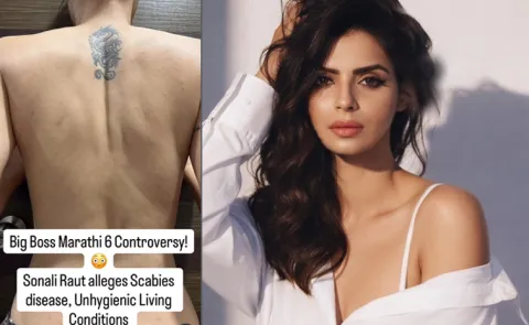 Bigg Boss Marathi 6 Sonali Raut Shares Video Of Severe Skin Infection