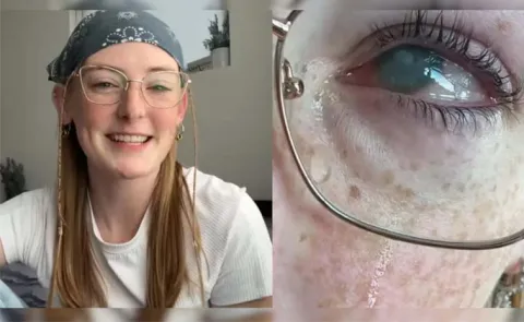 Grace Jamisons message is clear: never expose contact lenses to water