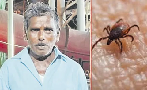 Scrub Typhus Kills Man in Andhra Pradesh