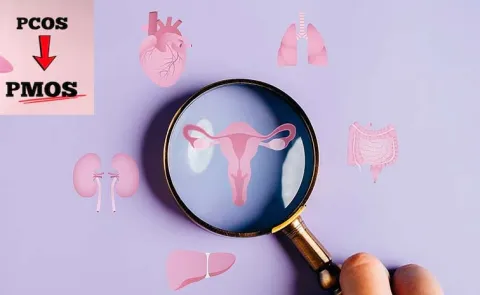 Health: PCOS Name Changed To PMOS