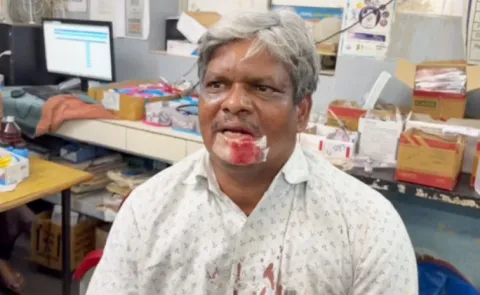 Lawyer Anjan Reddy Attacked by Minister Satyakumars Followers