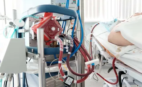 55 year old doctor survived weeks of respiratory failure infections septic shock