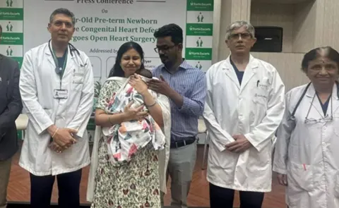 Bihar baby diagnosed with a rare heart defect surgery