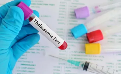 Health Tips: Thalassemia: Symptoms Causes And Treatment