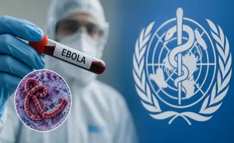 Ebola outbreak reaches 550 cases, at least 101 deaths in Congo