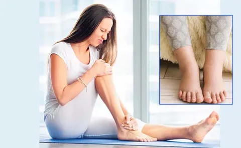 Precautions And Guidelines To Follow When Experiencing Leg Swelling