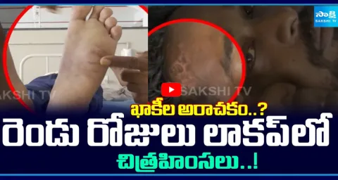 Alleged Custodial Torture: Victim Claims Two Days in Police Lockup 1