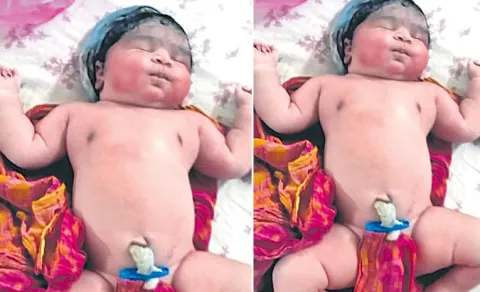 5.5 kg Baby Born at Government Hospital