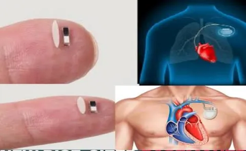 Wearable pacemaker uses ultrasound to control heart rhythm