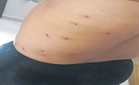 Pellet guns used against protesters in Delhi