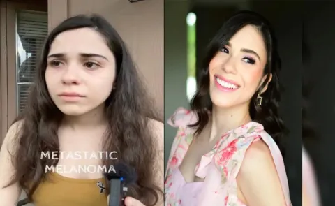 US Woman Go Of Skin Cancer At 26 After Leaving Heartbreaking Warning